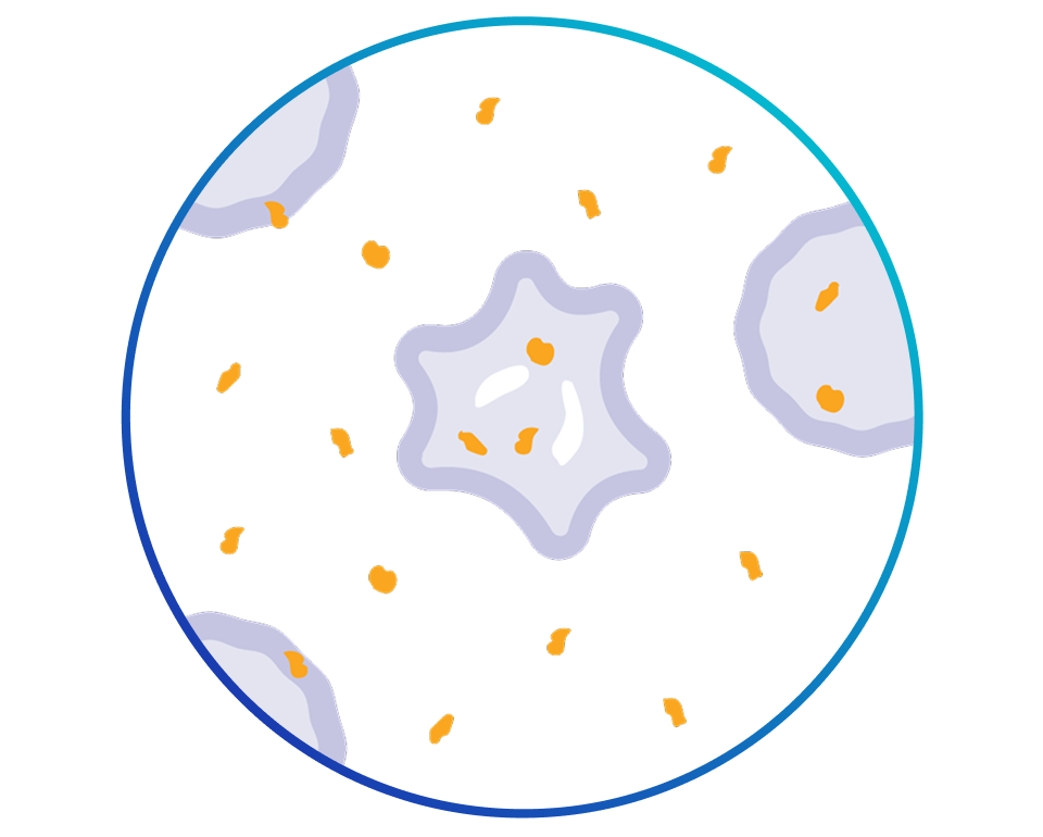 An illustration of the drug destroying cancer cells as well as other cells nearby.